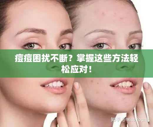 痘痘困扰不断?掌握这些方法轻松应对!